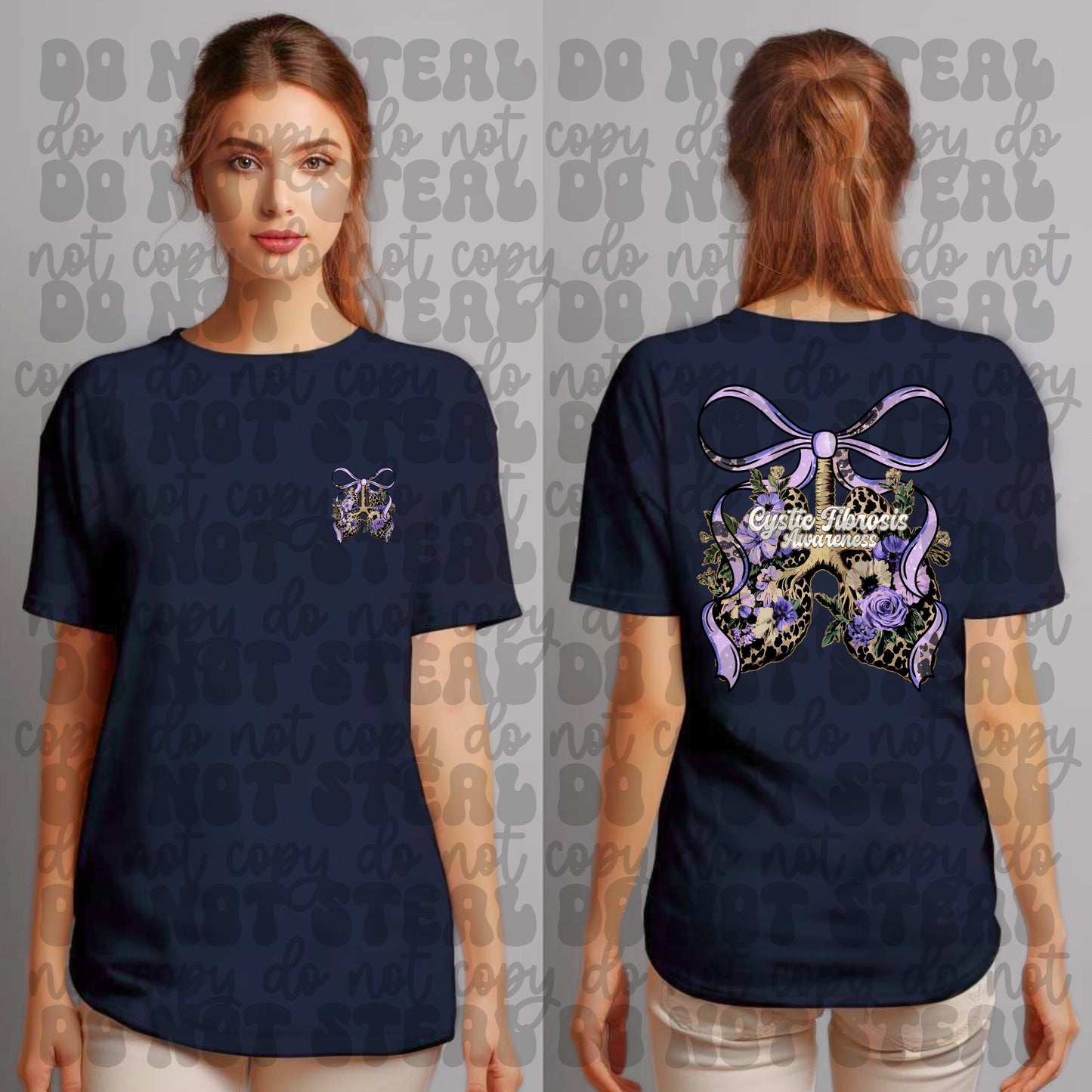 Cystic Fibrosis Double Sided
