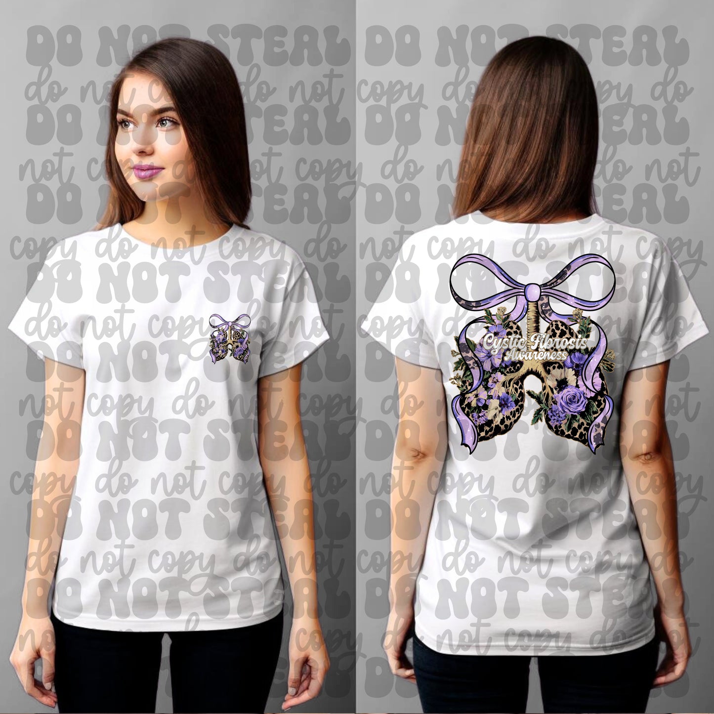 Cystic Fibrosis Double Sided