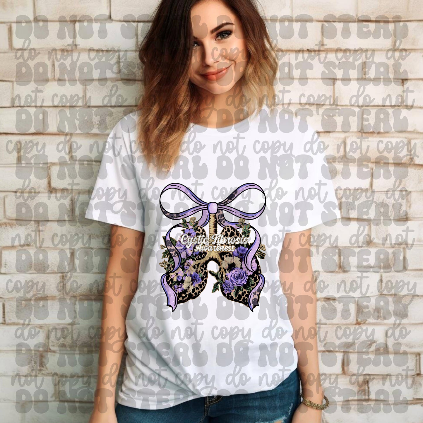 Cystic Fibrosis